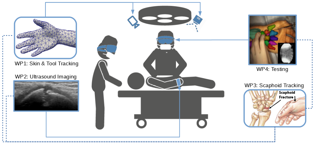 Flow chart of the HoloWrist Project